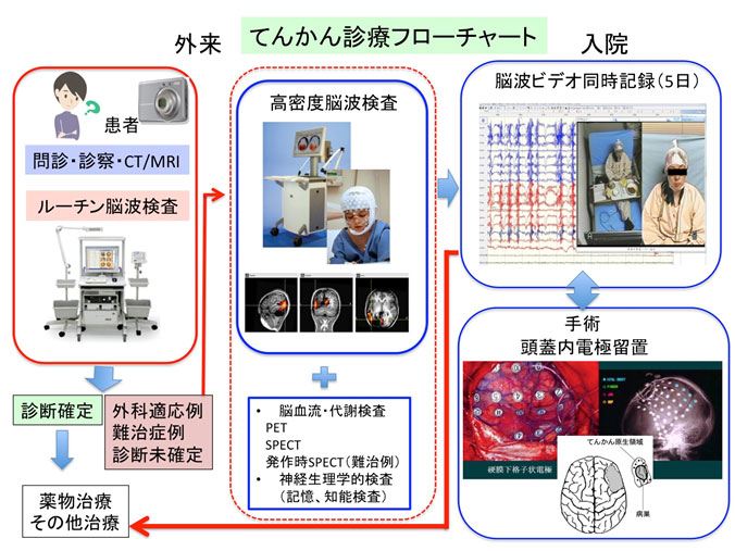 てんかん診療フローチャート