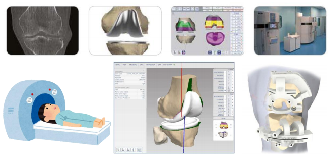 PMT（Patient Matched Technology）