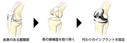 手術紹介 山口県立総合医療センター