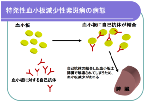 特発性血小板減少性紫斑病（ITP）説明画像