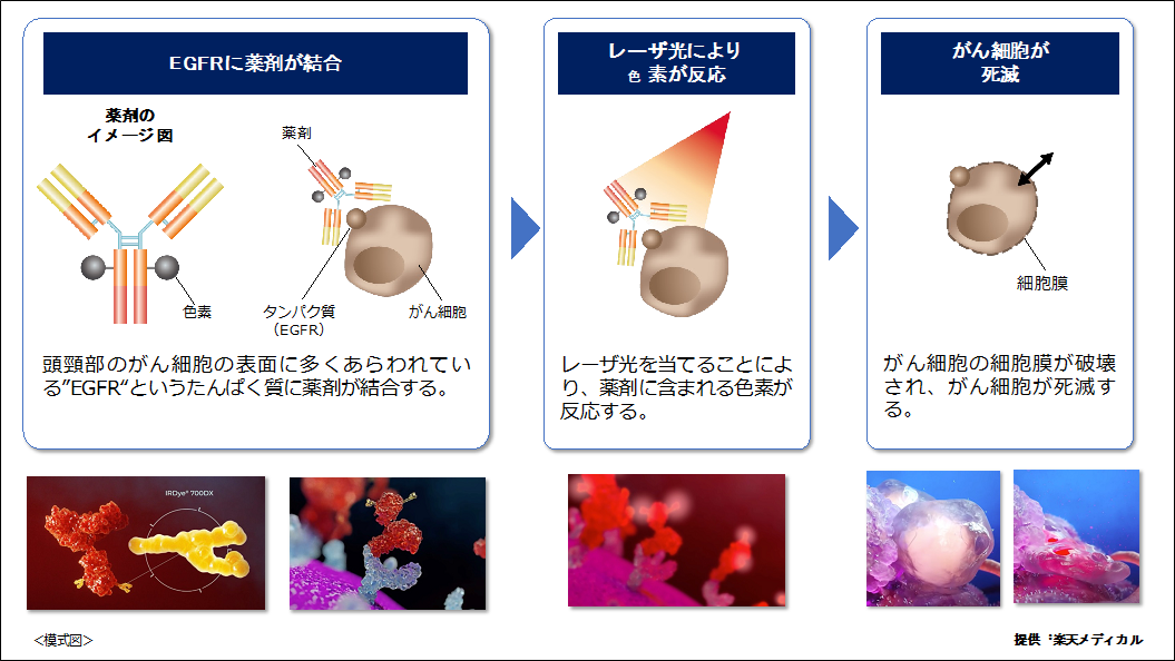 頭頸部癌への光免疫療法