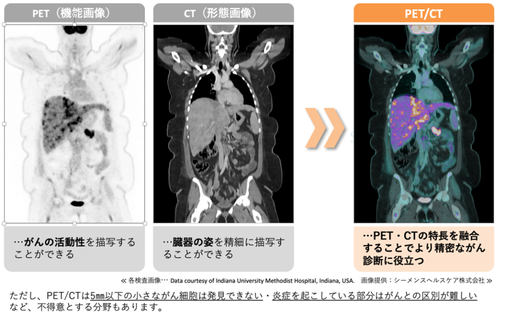 PET／CTについて