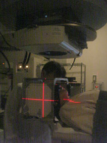 ライナック・ラジオサージャリーの実際9