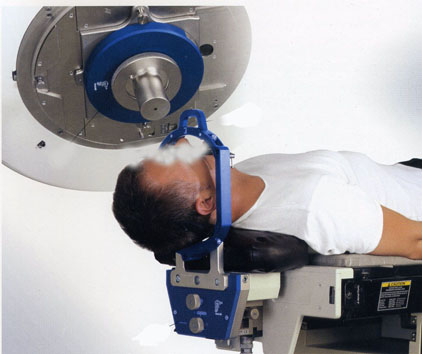 ライナック・ラジオサージェリー実施の様子