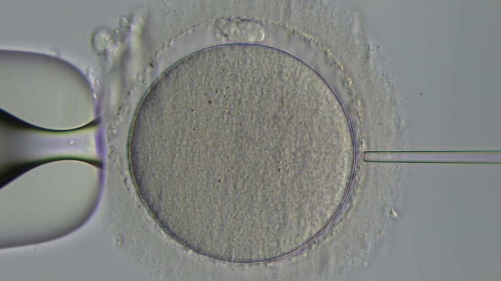 不妊治療の機器