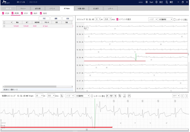 ホルター心電図、SASスクリーニング検査・解析